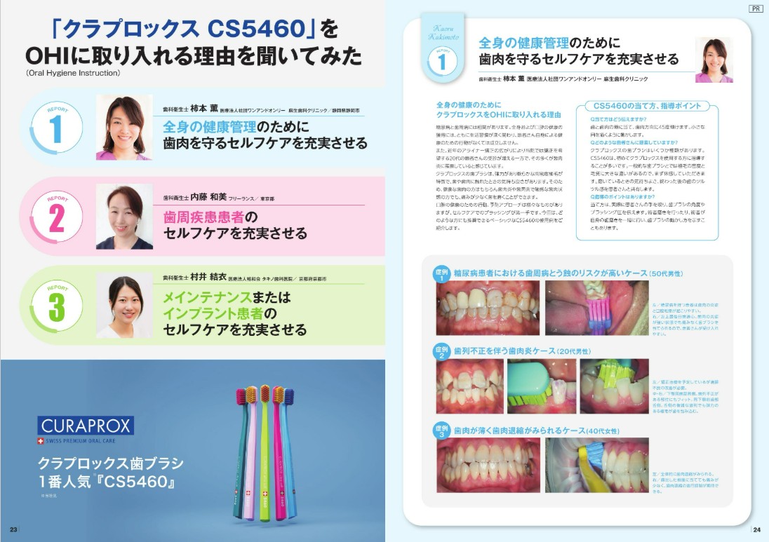 「クラプロックスCS5460」をOHIに取り入れる理由を聞いてみた