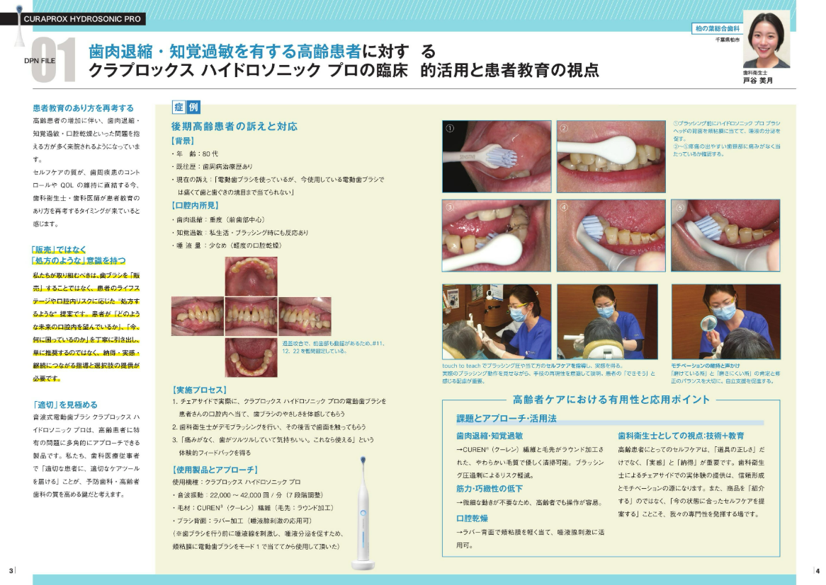 歯肉退縮・知覚過敏を有する高齢患者に対するクラプロックスハイドロソニックプロの臨床的活用と患者教育の視点